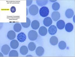 Pin On Pathology