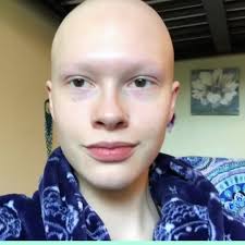 Cancer occurs when cells multiply rapidly and. Tyla Timeline Of Hair Growth After Chemotherapy Facebook