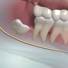 Many of the uk's dental schools offer dental work for free if you are happy for a student dentist to perform it. 140 Work Dental Ideas In 2021 Dental Dentistry Dentist
