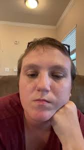 Is It Normal for Baby to Hit Their Head