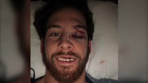 Sens Sabourin Provides Update After Scary Collision Versus Boston Ctv News
