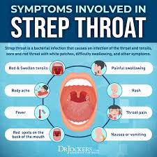 Image result for Strep throat infection roof of mouth