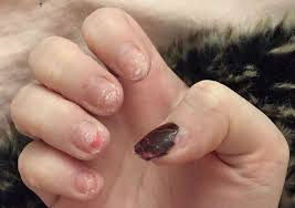 See the best & latest acrylic nail coupons near me on iscoupon.com. This Girl Has Shared The Reality Of An Acrylic Nail Addiction