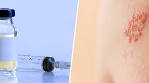 How i learned to stop worrying about ebola and just get a darn. Shingrix Shingles Vaccine Side Effects Shortages Age And More
