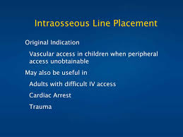 Image result for Difficult Intravenous Access in Children