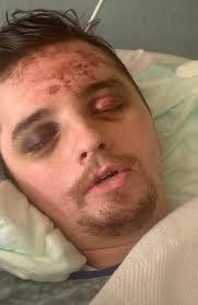 We are sure most of y'all know about Tucker Coldiron's accident. If anyone  wants to donate money we are going to include both he and Whitnies' Venmo's  to make it easy! @Tucker-Coldiron @