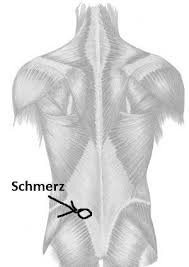 Rucken Schmerz Unten Links Bandscheiben Sport Ruckenschmerzen Bandscheibe