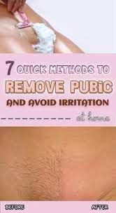 While home devices, including those utilizing intense pulsed light (see. Pubic Hair Removal Methods
