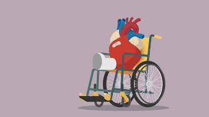 If you are 18 when you graduate from high school, add 15 years and you'll be around 33. Recovering From Open Heart Surgery 6 Things To Expect