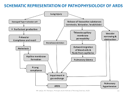 Ards Ppt