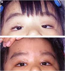 Image result for Blepharis transvaalensis