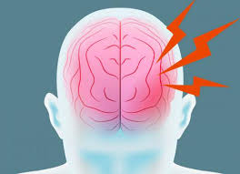 El accidente cerebrovascular (acv) es una afección médica en la que el flujo sanguíneo deficiente al cerebro produce muerte celular. Ictus Que Es Y Consecuencias De Un Accidente Cerebrovascular
