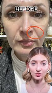 Eye bags and dark circles gone Repeat...