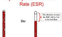 Image result for esr