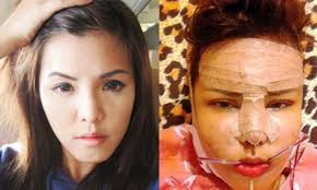 Đổi đời nhờ 'dao kéo'