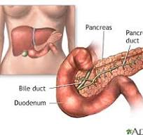 Type 1 diabetes: MedlinePlus Medical Encyclopedia