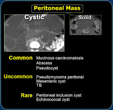 The multidisciplinary treatment team includes: The Radiology Assistant Peritoneal Pathology