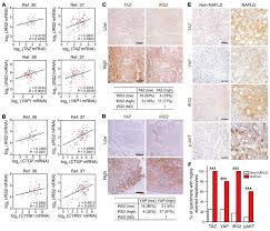 Liver cancer can be classified in two ways. Jci Hippo Mediated Suppression Of Irs2 Akt Signaling Prevents Hepatic Steatosis And Liver Cancer
