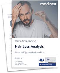 Vitex history & interesting facts. 41 Hair Loss Treatments Cost Before And After