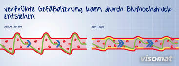 Wenn ein bluthochdruck entdeckt wurde, ist es erst recht wichtig, die werte durch regelmäßiges messen im. Blutdruck Naturlich Senken Was Hilft Visomat Blutdruckmessgerate
