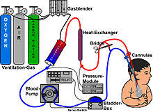 The ecmo machine replaces the function of the heart and lungs. Extracorporeal Membrane Oxygenation Wikipedia