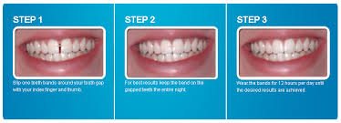 There are some very common procedures that can help you get rid of this dental problem in no time. Close Teeth Gaps Professional Orthodontic Elastic Latex Free Bands Ebay