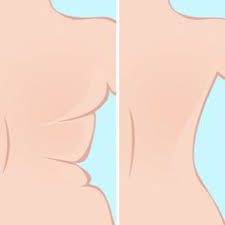 Eine gute körperhaltung ist die. Wir Haben Fur Euch Die Funf Besten Ubungen Gegen Ruckenspeck Zusammengestellt So Werdet Ihr Die Lastigen Rollchen Unter Dem Bh End Ruckenspeck Ubungen Fitness