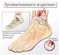 Share skript einführung ins cfs zweite fassung everywhere for free. Syndesmose Gelenk Klinik De