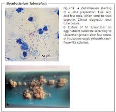 Global Indoor Health Network - Gram Positive
