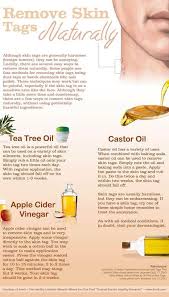 Remive Tags Naturally With Castor Oil Tea Tree Oil Or Vinegar Remove Skin Tags Naturally Skin Tag Removal Skin Tag
