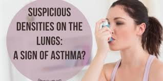 Send thanks to the doctor. Suspicious Densities In The Right Upper Lobe For Apicolordotic View Other Respiratory Disorders Discussions Body Health Conditions Center Steadyhealth Com