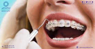 تحرك الاسنان بعد التقويم التجميعي