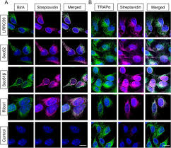 Check spelling or type a new query. Heterogeneous Translational Landscape Of The Endoplasmic Reticulum Revealed By Ribosome Proximity Labeling And Transcriptome Analysis Journal Of Biological Chemistry