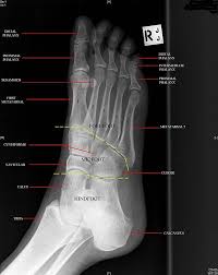 Foot Oblique Radiologymasterclass Co Uk Radiology Student Medical Anatomy Medical Knowledge