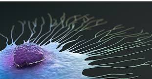 The breast typically becomes red, swollen, and warm with dilation of the pores of the breast skin. Joining Forces To Fight Inflammatory Breast Cancer Froedtert Mcw