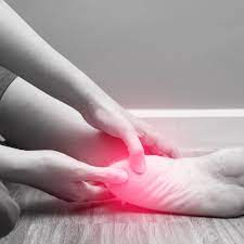 A bad headache can be a frightening experience. Conditions Often Mistaken For Plantar Fasciitis
