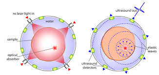 How to detect radio wave (radio wave detector)! Hearing Radio Frequencies Xcorr Comp Neuro