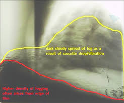 Light Fog Artefacts An Open Edge Of The Cassette Before And After Download Scientific Diagram