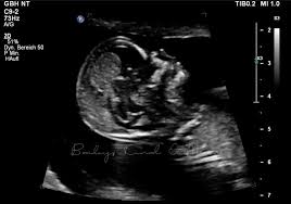 Schwanger Mit Wunschbaby Nr 4 Von Der 11 Ssw Bis Zur 13 Ssw Familie Baby Kind Und Meer