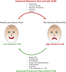 Image result for Necrotizing Enterocolitis