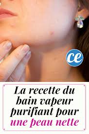 Peaux A Problemes Mon Bain De Vapeur Purifiant Pour Une Peau Nette Recette Peau Trop De Maquillage Vapeur Visage