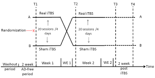 Flow Chart Of The Experimental Itbs Treatment Procedure