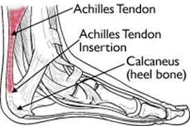 It is the tendinous extension of the the achilles tendon must withstand very high forces, especially when jumping and landing. Achilles Tendinitis Orthoinfo Aaos