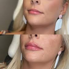 👋🏼 Hello, my name is Dani & I thought I would reintroduce myself to all  my new followers...⁠ ⁠ I am a board-certified Nurse Practitioner with over  a decade of experience in