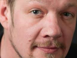 Fundraiser by Donna Stallings : Michael Ooms Metastatic Cancer Costs