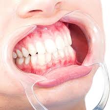 3 Ways To Talk With Your Mouth Closed - Wikihow