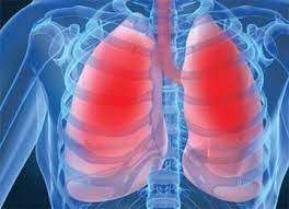 Sakit kepala kerana kemarahan boleh menyebabkan ketegangan otot saraf dan leher serta migrain atau sakit kepala. Nafas Tercungap Kesan Penyakit Sekatan Pulmonari Kronik Tips Dan Info Kesihatan Keluarga