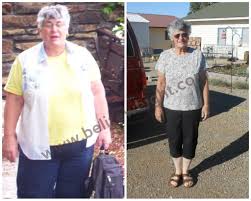 Pin On Weight Loss Success Stories Before And After Photos Videos