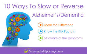 Are You Going To Get Alzheimer S Disease Healthy Concepts With A Nutrition Bias Alzheimers Alzheimer S Disease Alzheimer S Prevention