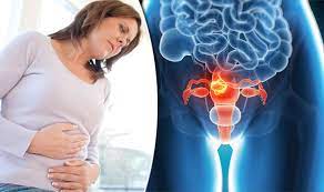 A persistent cough could be a symptom of lung cancer or head and neck cancer. Womb Cancer Symptoms Signs You Could Have Cancer Of The Uterus Express Co Uk